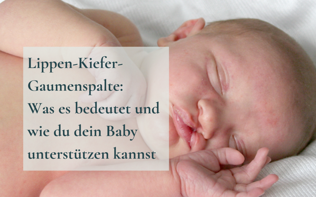 Lippen-Kiefer-Gaumenspalte: Was es bedeutet und wie du dein Baby unterstützen kannst